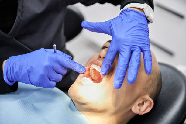 Best Emergency Dental Care for Broken or Chipped Teeth in Appalachia, VA